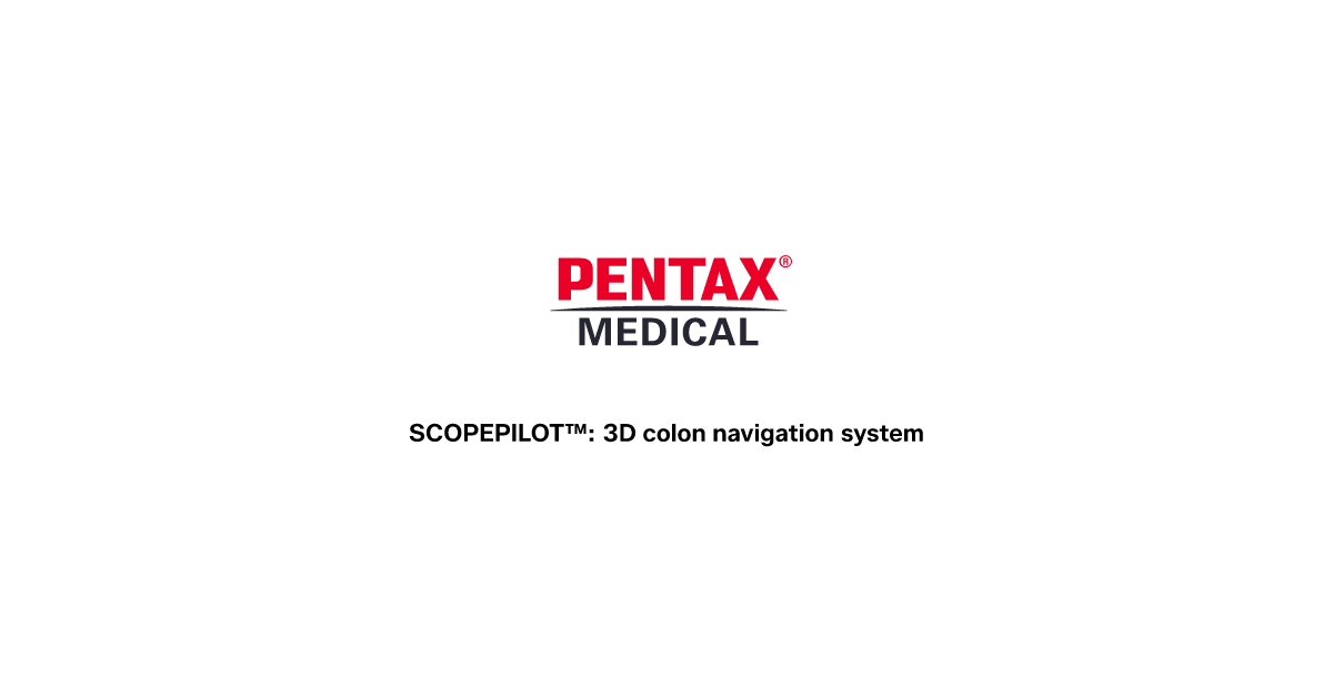 Next-Generation 3D colon navigation system | SCOPEPILOT