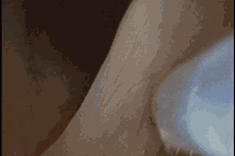 needle insertion