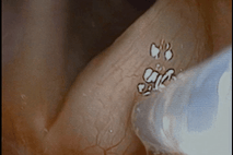 injection